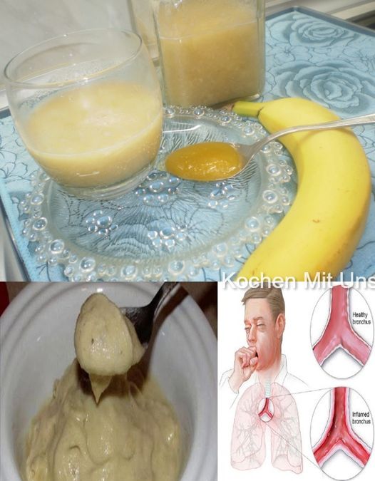 Wow, smíchejte banány, med a vodu a kašel i bronchitida úplně zmizí